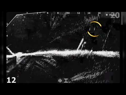 Видео: Запись эхограммы Lowrance Active Target 1