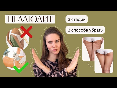 Видео: ЦЕЛЛЮЛИТ. Причины появления. Как избавиться? Самые эффективные средства