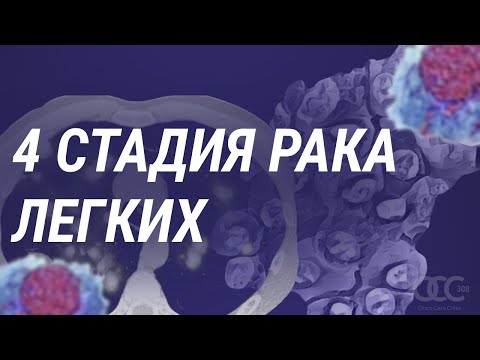 Видео: 4 стадия рака легких. Как жить дальше?