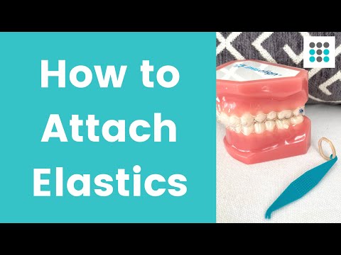 Видео: КАК НАДЕВАТЬ ЭЛАСТИКИ НА ПРОЗРАЧНЫЕ ЭЛАСТИНЫ. Доктор Мелисса Бейли