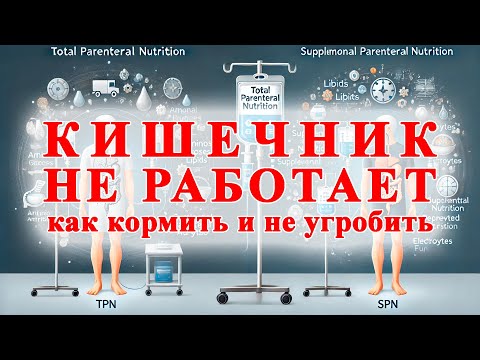 Видео: Кишечник не работает: как кормить и не угробить — полный и добавочный парентеральный подход
