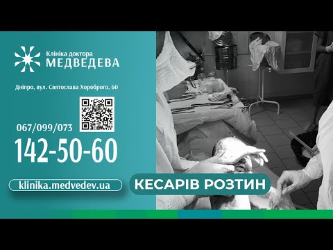 Видео: Кесарів розтин