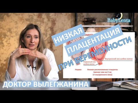 Видео: Низкая плацентация при беременности - что это такое, причины, опасность, что делать!