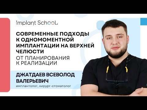 Видео: Современные подходы к одномоментной имплантации на верхней челюсти: от планирования к реализации