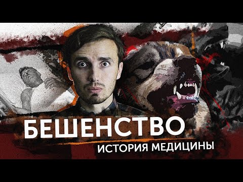 Видео: БЕШЕНСТВО - [История Медицины]