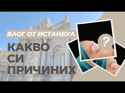 Видео: ВЛОГ ОТ ИСТАНБУЛ | Направих си ринопластика 👃🏼🌉🇹🇷 част 2