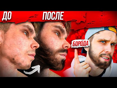Видео: Лучший Способ Отрастить МУЖИЦКУЮ БОРОДУ! МИНОКСИДИЛ (minoxidil)
