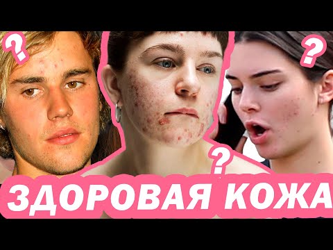 Видео: ЭТО СДЕЛАЕТ ТВОЮ КОЖУ ЗДОРОВОЙ !!!