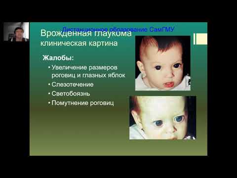 Видео: Глаукома