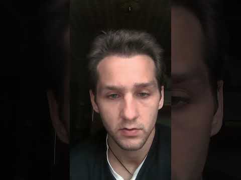 Видео: 4,5 МЕСЯЦА ПОСЛЕ ПЕРЕСАДКИ ВОЛОС В МОСКВЕ.