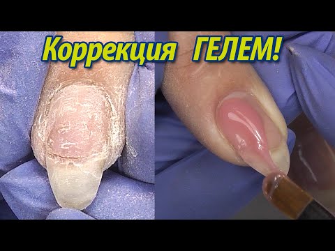 Видео: Маникюр : Коррекция ГЕЛЕМ -- Ноготь ТРЕСНУЛ! пополам / Борьба с отслойками / Оксана Маляренко