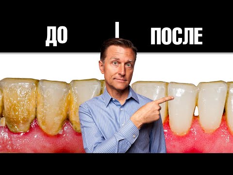 Видео: Лучший способ избавиться от зубного налета и зубного камня 🔥