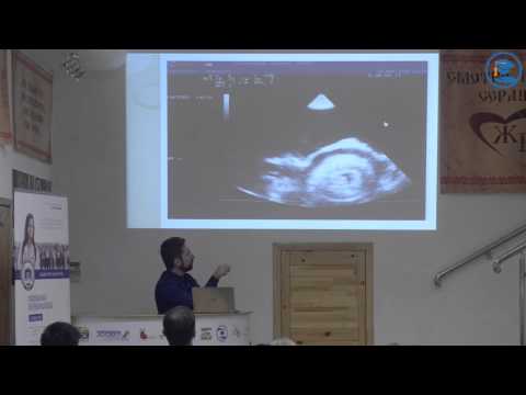 Видео: «Патологии перикарда», А. Н. Бокарев