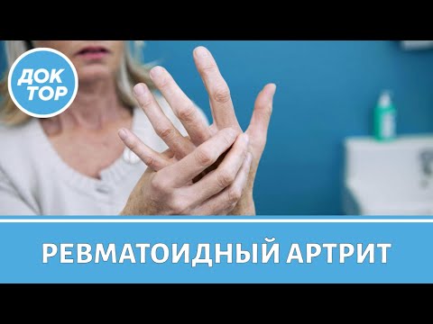 Видео: Что может спровоцировать развитие ревматоидного артрита