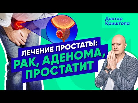 Видео: Простатит, аденома простаты и рак предстательной железы. Уролог о симптомах и лечении