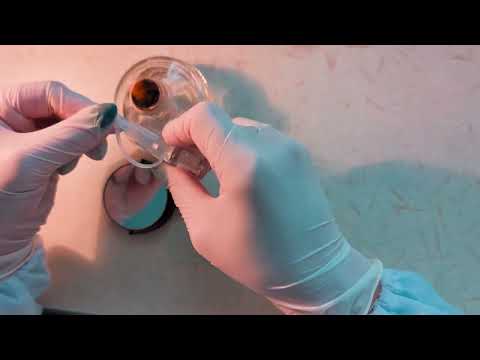 Видео: Аглютинація сальмонельозними сироватками 