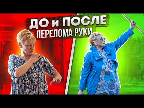 Видео: Как быстро РАЗРАБОТАТЬ РУКУ ПОСЛЕ ПЕРЕЛОМА по оздоровительной методике ЧЕРЕНОК от доктора Чернова