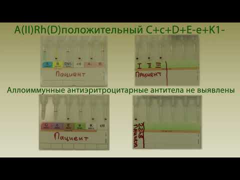 Видео: Проведение индивидуального подбора