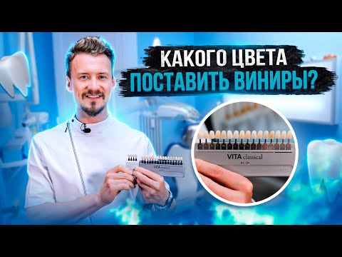 Видео: Как выбрать цвет виниров?