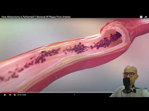 Видео: 8.24. Жүрек-қан тамырлары жүйесінің аурулары