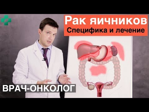 Видео: Рак яичников. Специфика и лечение рака яичников