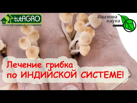 Видео: "НОГИ ИНДУСА" - СПОСОБ ПОЛНОГО ИЗЛЕЧЕНИЯ ГРИБКА НАТУРАЛЬНЫМИ СРЕДСТВАМИ!