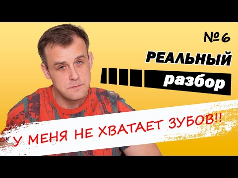 Видео: Нет зубов, адентия! Исправляем прикус в реальном времени!