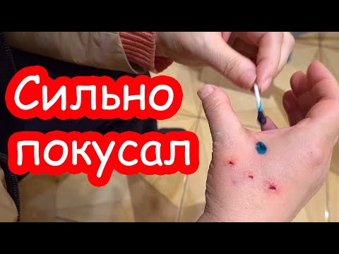 Видео: VLOG Сильно покусал