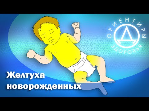 Видео: Желтуха новорожденных