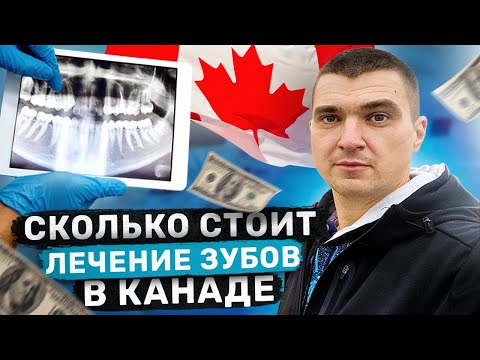 Видео: ЛЕЧИТЬ ЗУБЫ В КАНАДЕ ДОРОГО ? СКОЛЬКО СТОИТ ЛЕЧИТЬ ЗУБЫ В КАНАДЕ