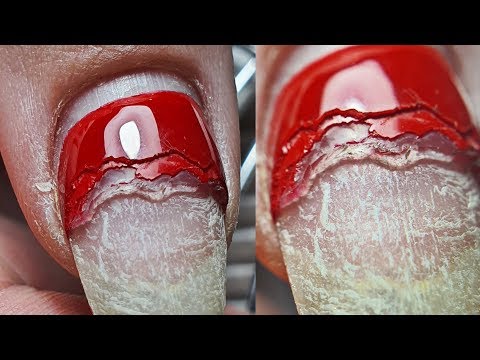 Видео: Бедные ногти😱🙈