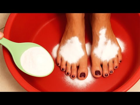 Видео: Я нанесла БИКАРБОНАТ НАТРИЯ на СТОПЫ - и вот что произошло!