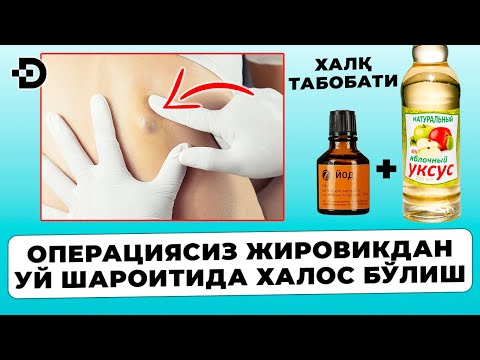 Видео: ЛИПОМА ЖИРОВИК УЙ ШАРОИТИДА ХАЛОС БЎЛИНГ. ХАЛҚ ТАБОБАТИ