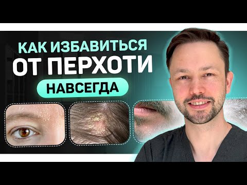Видео: Перхоть. Реальные причины. Как избавиться навсегда?