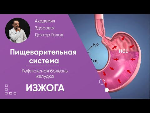 Видео: Рефлюксная болезнь желудка - ГЭРБ.