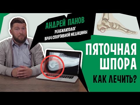 Видео: Боль в пятке и пяточная шпора. Симптомы и лечение фасциита | Андрей Панов