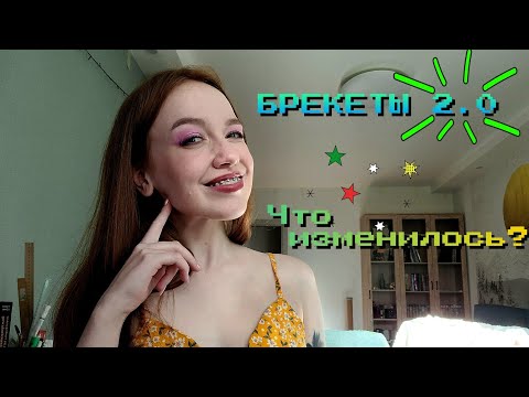 Видео: ПОСТАВИЛИ БРЕКЕТЫ. ВОСПАЛЕНИЕ НЁБА. ЧТО НОВОГО?