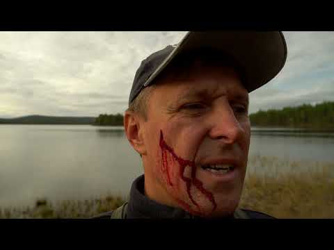 Видео: Север. Ранение ,неоткуда ждать помощи, один в лесу.