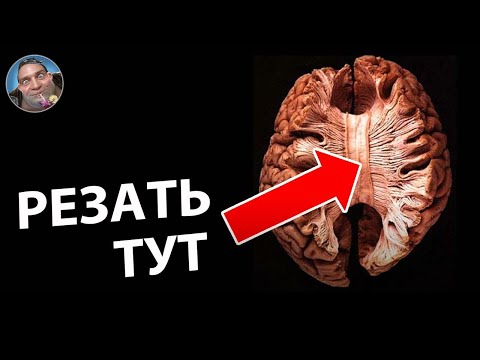 Видео: Неудобная Правда о СОЗНАНИИ | Опыт Расщепления Который Шокировал Ученых