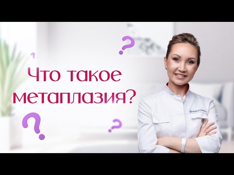 Видео: Что такое метаплазия? Опасно ли развитие метаплазии в желудке? Есть ли риск развития рака желудка?