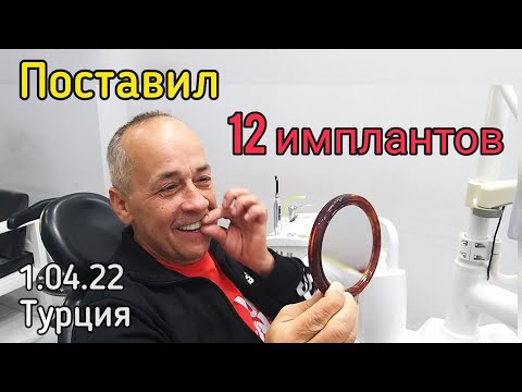 Видео: Турция 2022. Сколько стоило поменять все зубы. Стоматология в Турции. #lenavanea #мерсин