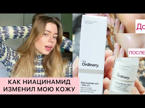 Видео: НИАЦИНАМИД | КАК МОЮ КОЖУ ИЗМЕНИЛ THE ORDINARY NIACINAMIDE , как правильно использовать , постакне