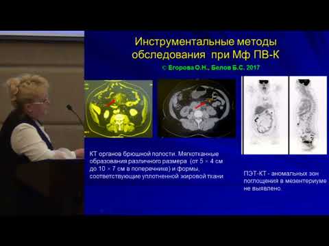 Видео: Егорова О.Н. Панникулит Вебера-Крисчена: диагностика и подходы к лечению | Липодерматосклероз