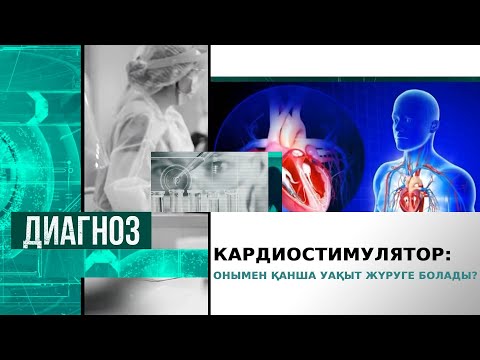 Видео: Кардиостимулятормен қанша уақыт жүруге болады? | Диагноз