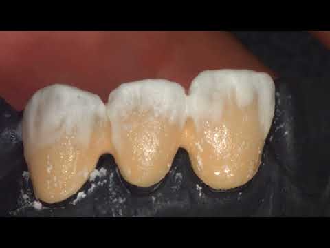 Видео: Транспарент