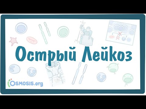 Видео: ОСТРЫЙ ЛЕЙКОЗ - Острый миелобластный и лимфобластый лейкоз