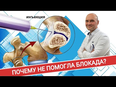 Видео: ТОП-5 ПРИЧИН, ПОЧЕМУ ВАМ НЕ ПОМОГЛА БЛОКАДА