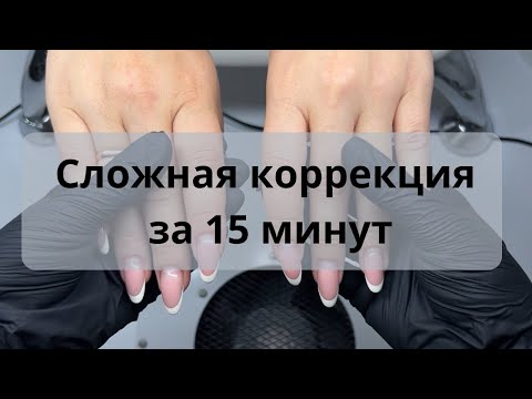 Видео: Поднимаем клюющие ногти за 15 минут