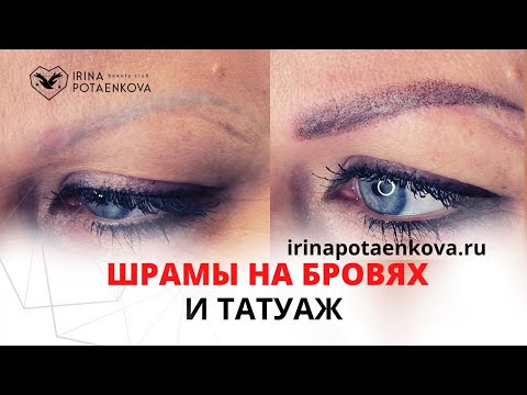 Видео: Татуаж шрамов на бровях