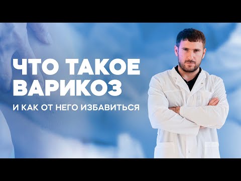 Видео: ЛЕЧЕНИЕ ВАРИКОЗА на ногах. Варикозное расширение вен.